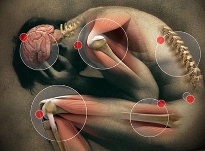 CARACTERÍSTICAS DEL DOLOR NEUROPÁTICO