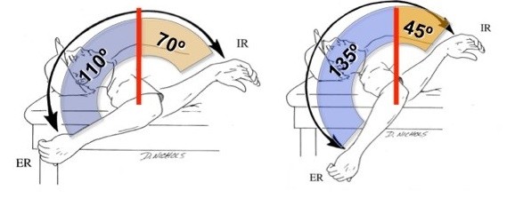 Dolor de hombro y deporte. Déficit de Rotación Interna Glenohumeral