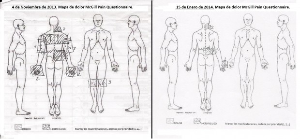 CASO CLÍNICO. FIBROMIALGIA Y FISIOTERAPIA