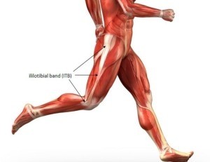 Tendinitis del tensor de la fascia lata (TFL)