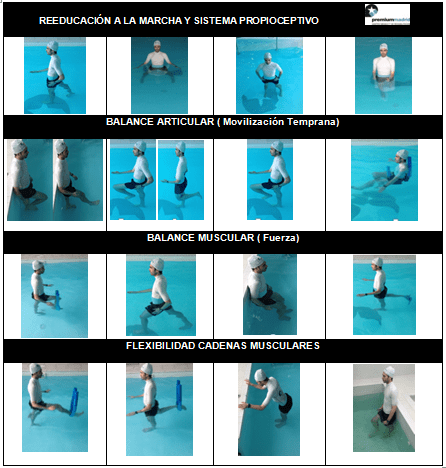 HIDROTERAPIA EN LA RECUPERACIÓN DE LIGAMENTO CRUZADO ANTERIOR (Recuperación funcional)