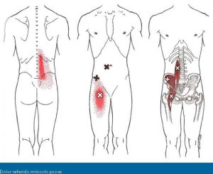 fisioterapia-lumbalgia-madrid