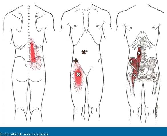 Músculo psoas ilíaco: función y acción