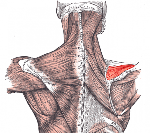 CASO CLÍNICO: TENDINOSIS DE SUPRAESPINOSO Y LIMITACIÓN DEL MOVIMIENTO