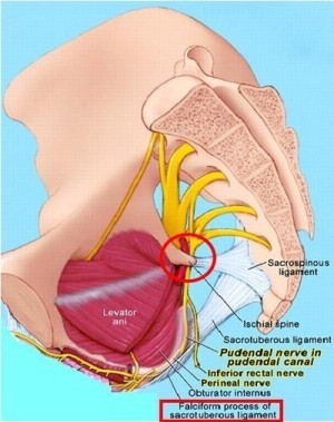 ATRAPAMIENTO DEL NERVIO PUDENDO: ANATOMÍA Y SÍNTOMATOLOGÍA