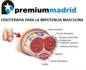 IMPOTENCIA-MASCULINA