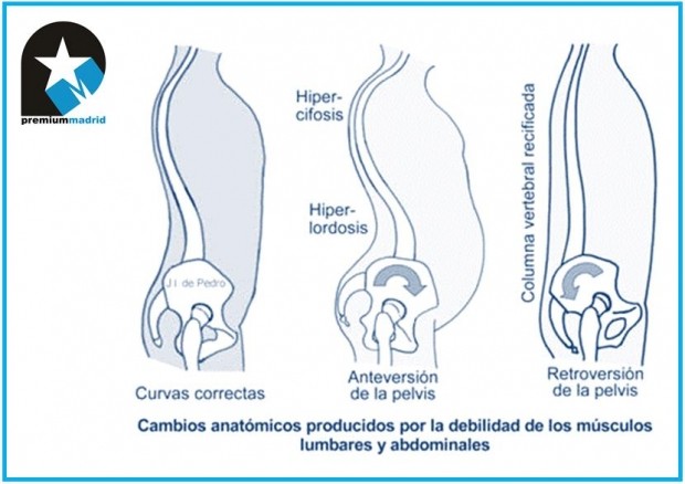 Anatomía y biomecánica de la columna dorsal y lumbar o raquis dorsal y lumbar