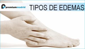 tipos de edemas