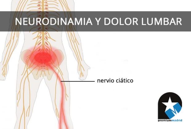 Neurodinamia y dolor lumbar