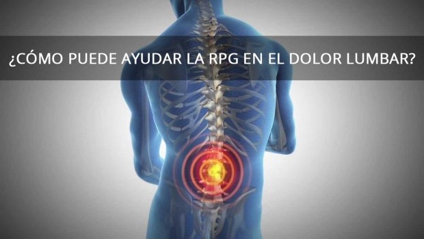 ¿Cómo puede ayudar la RPG en el dolor lumbar?