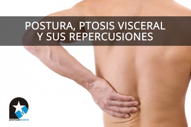 Postura, ptosis visceral y sus repercusiones