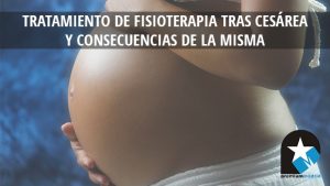 tratamiento de fisioterapia cesarea - Premium Health & Sport