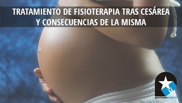 Tratamiento de fisioterapia tras cesárea y consecuencias de la misma