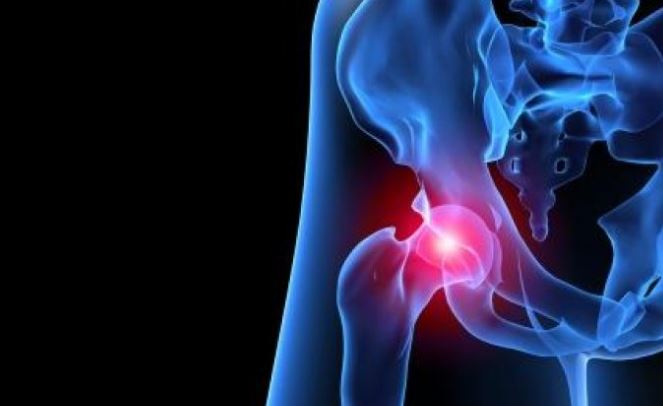 ¿Qué es el choque femoroacetabular?