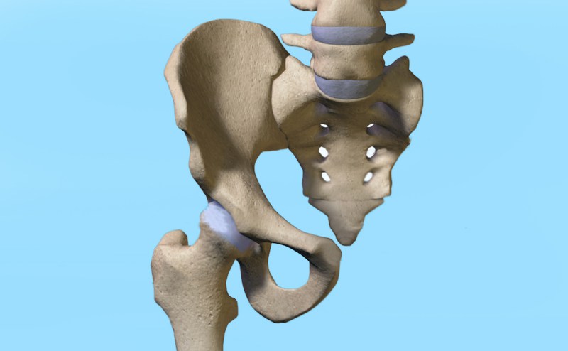 Dolor referido a la articulación sacroiliaca