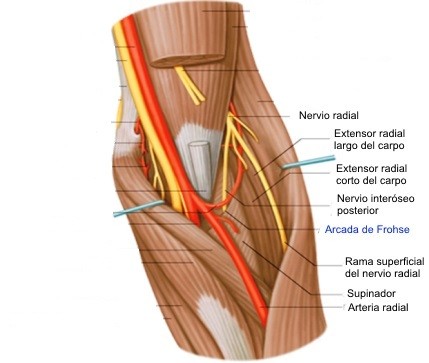 Epicondilalgia lateral y su relación con el nervio radial