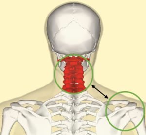 Implicación de la columna cervical en el dolor de hombro