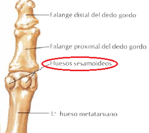 Sesamoiditis, ¿qué es y cómo tratarla?