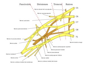 clasificacion lesiones plexo braquial