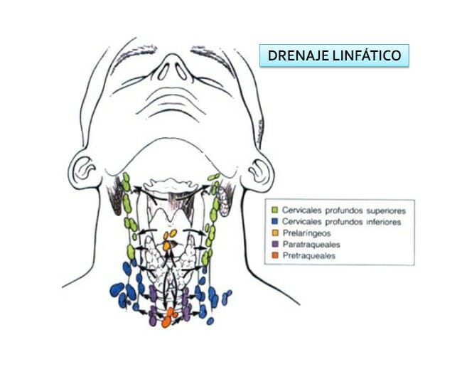 Edema facial tras fascitis necrotizante facial