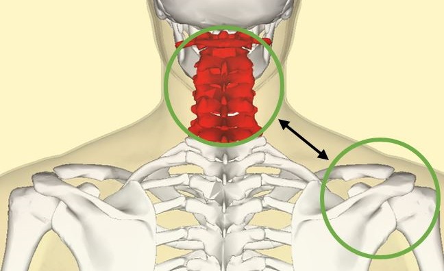 Caso clínico. Tendinopatía del manguito rotador y su relación con la columna cervical