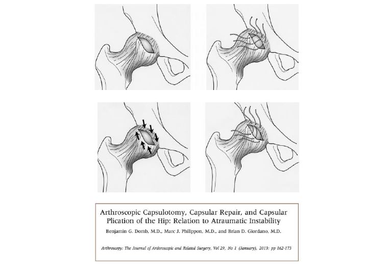 artroscopia