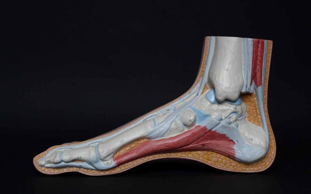 Disfunción del tendón tibial posterior: Introducción, causas y tratamiento.