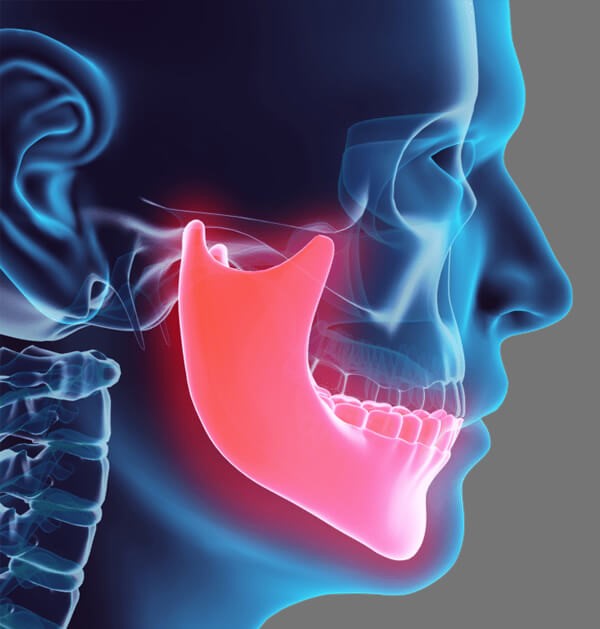 Dolor orofacial