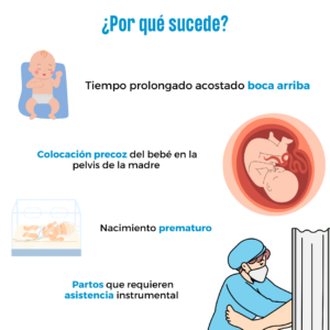 Plagiocefalia posicional