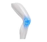 Rodilla